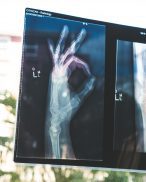 An x-ray, if you had to leave work for medical issues and were retaliated against, call our Oakland attorney today.